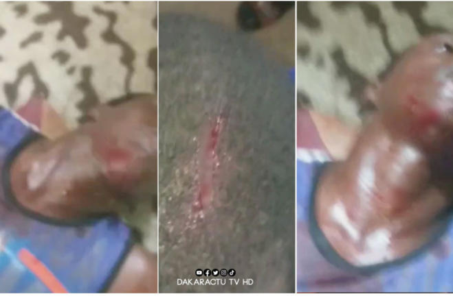 Mutinerie au Camp pénal de Liberté 6 : Des détenus blessés par balles à blanc...