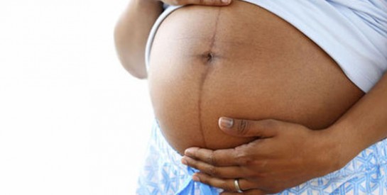 GROSSESSE : CETTE ÉTRANGE LIGNE NOIRE QUI APPARAÎT SUR LE VENTRE DES FEMMES ENCEINTES