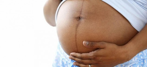 GROSSESSE : CETTE ÉTRANGE LIGNE NOIRE QUI APPARAÎT SUR LE VENTRE DES FEMMES ENCEINTES